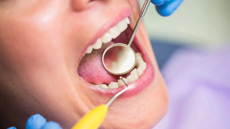 process on patient by doctor for dental filling in front tooth