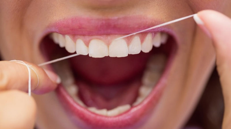 various types of flossing methods and tools